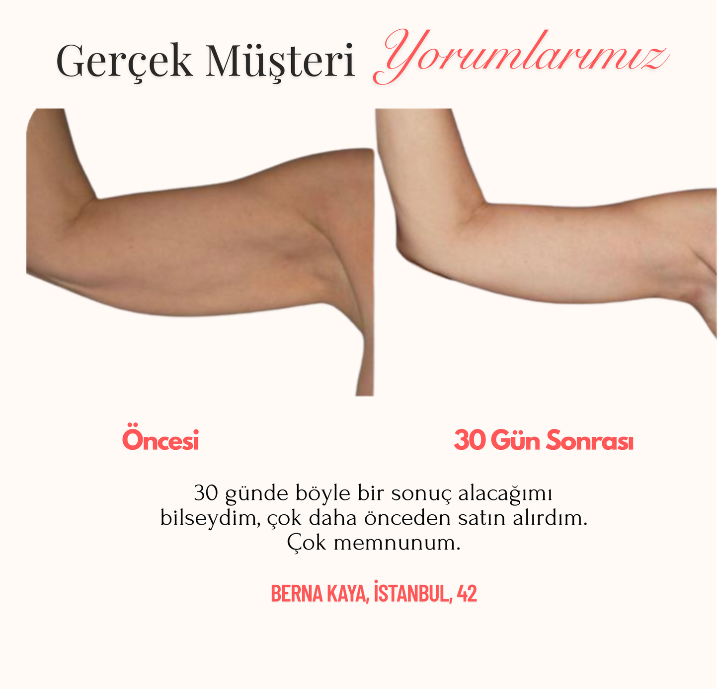 Kızılötesi Bant